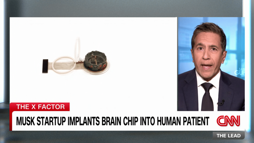 First Neuralink Human Trial Subject Can Control A Computer Mouse With