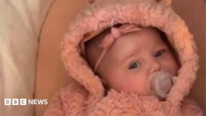 Mother Guilty Over Infant's Hairdryer Burns