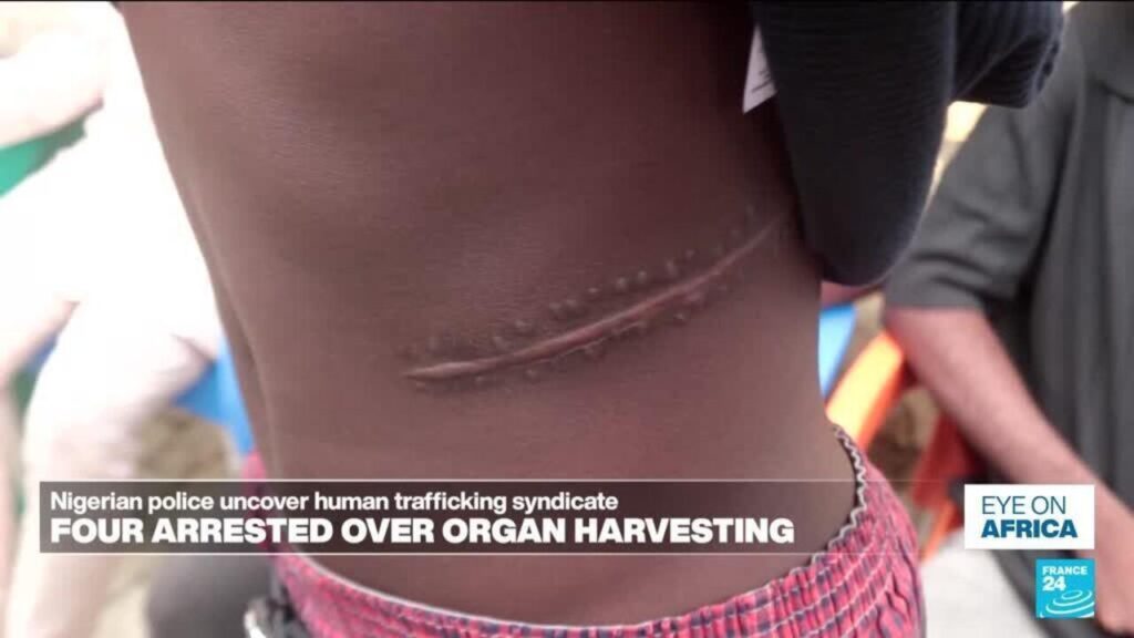 Nigeria Organ Harvesting Loopholes Examined