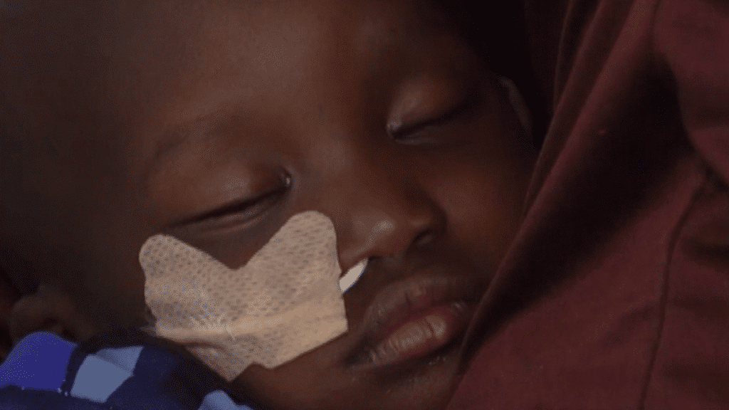 Nigeria Faces Rising Malnutrition as Food Costs Climb