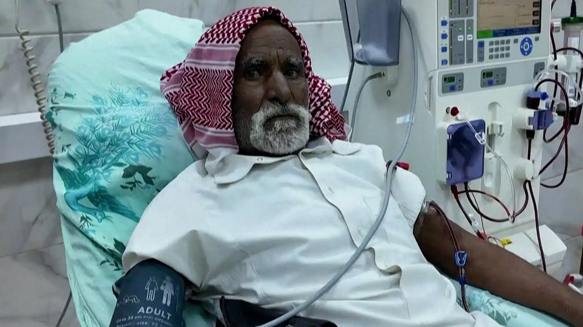 Taiz Healthcare Crisis Deepens as Fighting Cuts Supplies